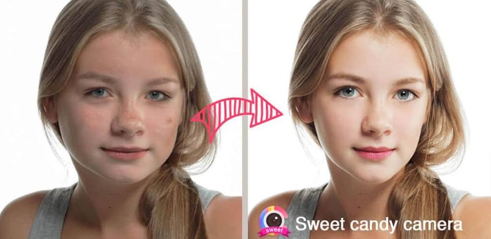 Sweet Candy Cam MOD APK v4.8.1726 Download (Premium Unlocked)